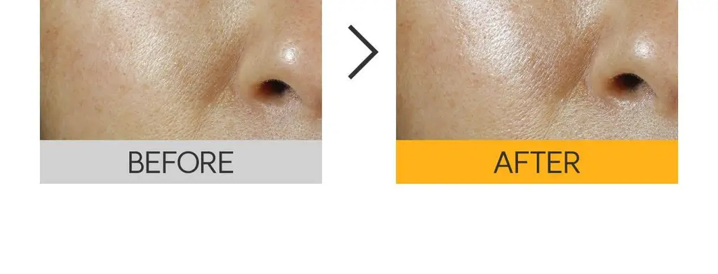 [잡티흔적케어/광채 PDRN] 로벡틴 비타 더블 토닝 크림 50ml 상세페이지 23